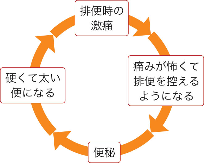 裂肛の慢性化への負のスパイラル